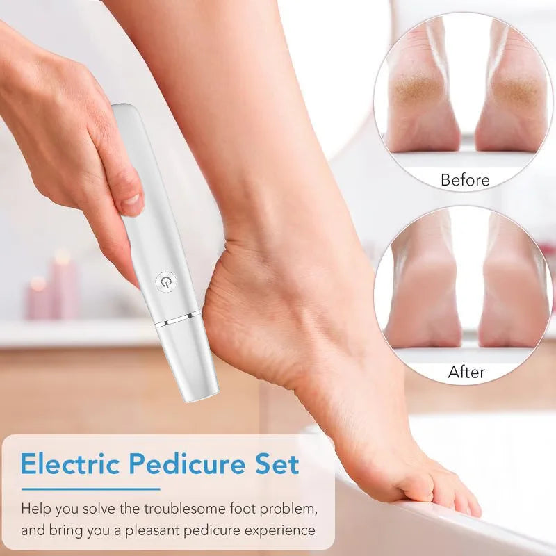 Removedor Eléctrico de Callos para los Pies